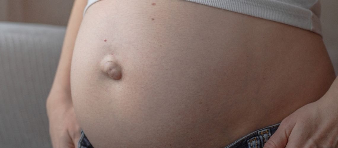 Umbilical Hernia During Pregnancy: What Do You Need to Know? Umbilical Hernia During Pregnancy: What Do You Need to Know?
