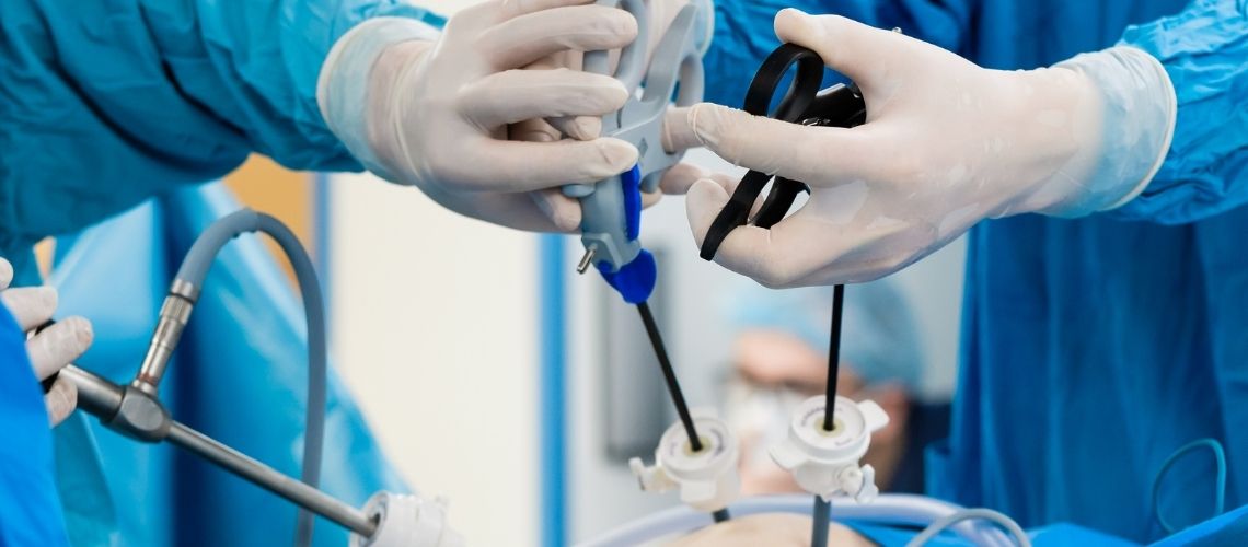 What Is Laparoscopic Surgery and How Is It Performed? What Is Laparoscopic Surgery and How Is It Performed?