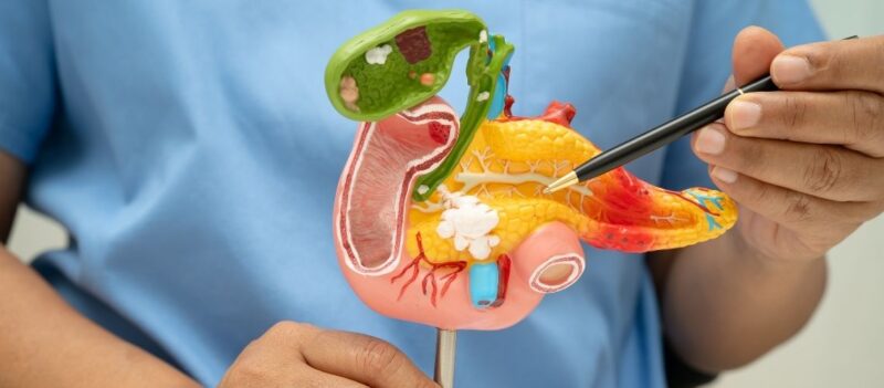 Reviews & Complaints from Patients Who Had Gallbladder Surgery Reviews & Complaints from Patients Who Had Gallbladder Surgery