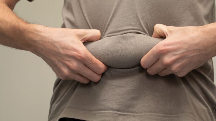 Tüp Mide Ameliyatı Sonrası Kilo Kaybı Duraklaması (Plato)