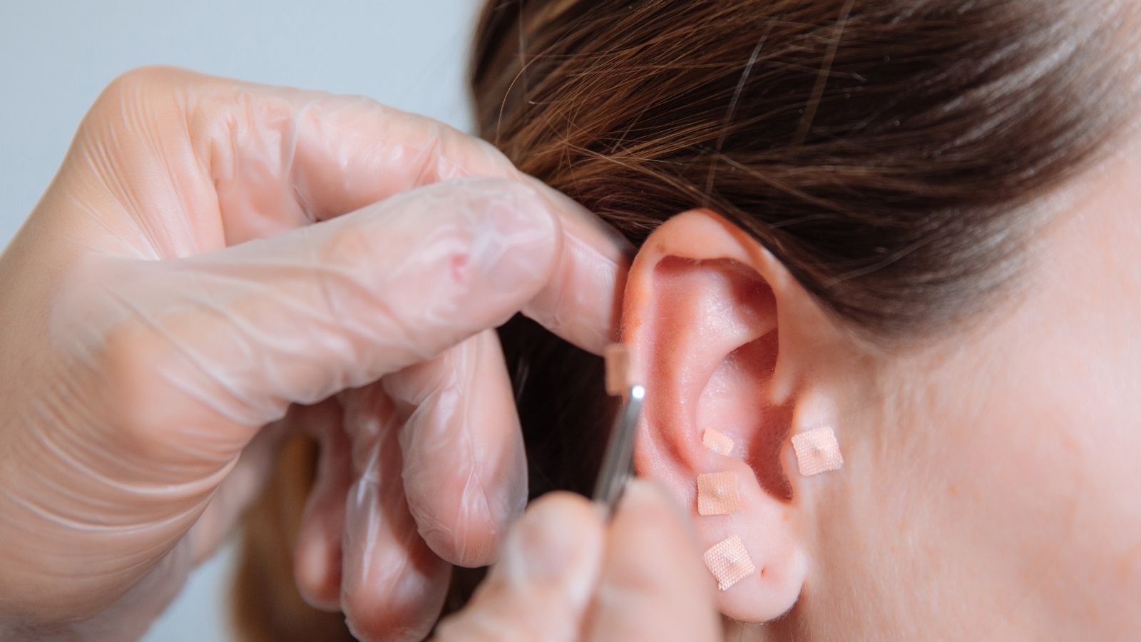 Sei Jung İştah Kapatma Yöntemi Nedir?